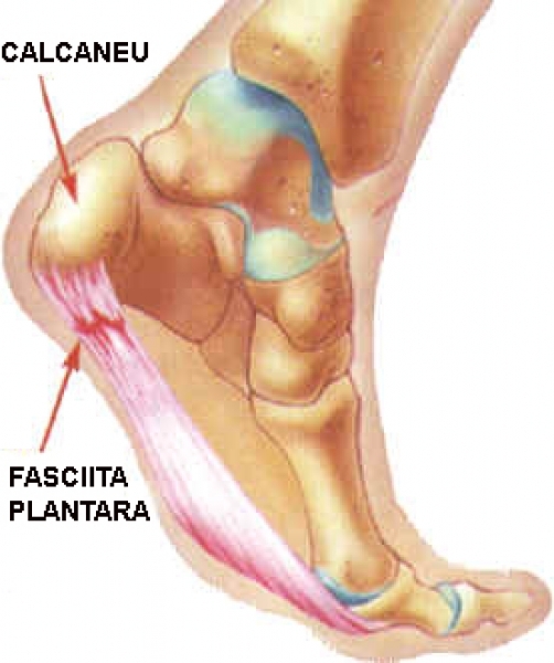 dureri articulare de călcâi la spate artroza tratamentului mâinilor și gimnastică
